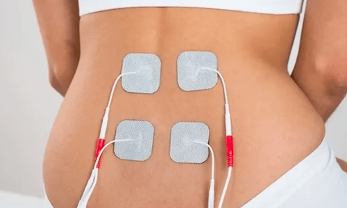 Neuroestimulação Eléctrica Transcutânea (Abordagem Suíça)